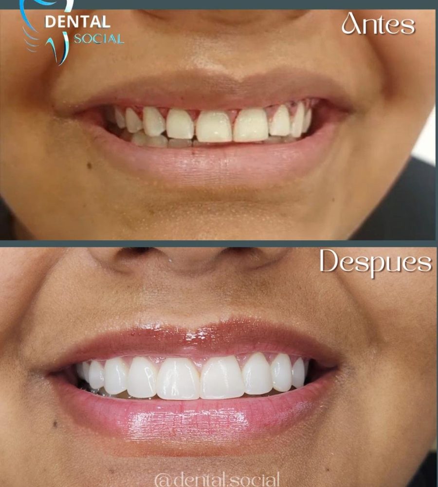 Equipo Dental Social en Medellín